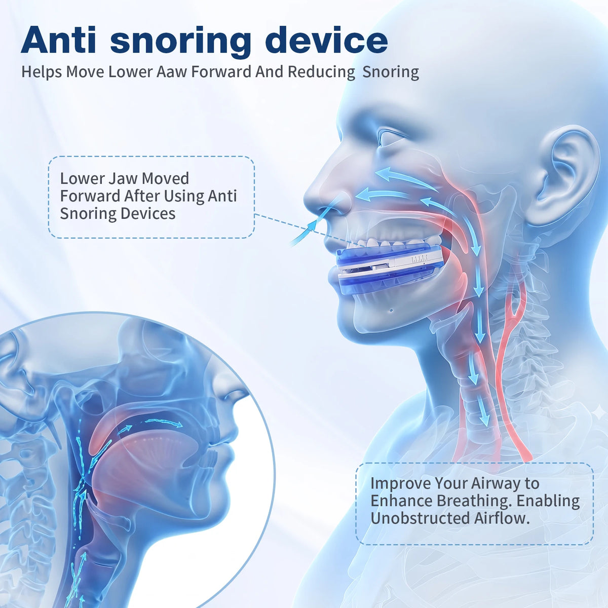Adjustable Anti Snoring Mouthpiece, Boil And Bite Sleep Aid Device