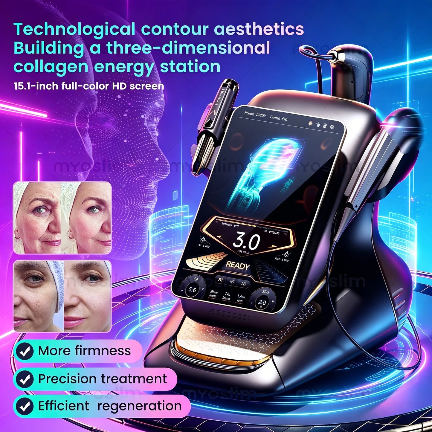 25D 360 Max RF Anti Aging Facial Body Portable Rejuvenation