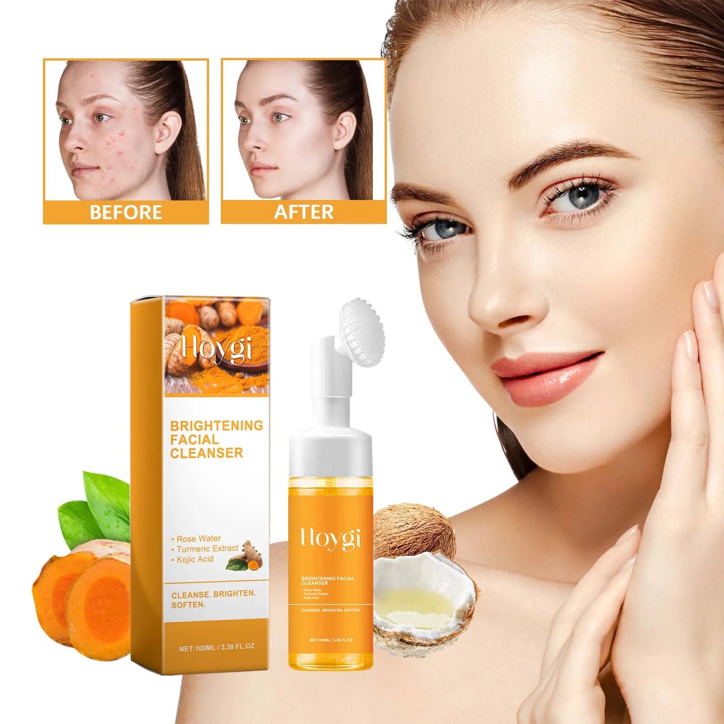 Hoygi Turmeric Kojic Acid Exfoliating Face Cleanser