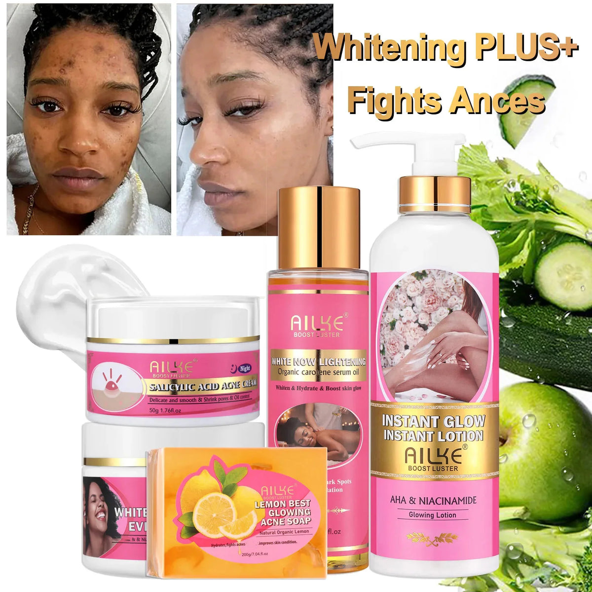 AILKE Natural Skin Brightening Moisturizing Acne Care Cream Set