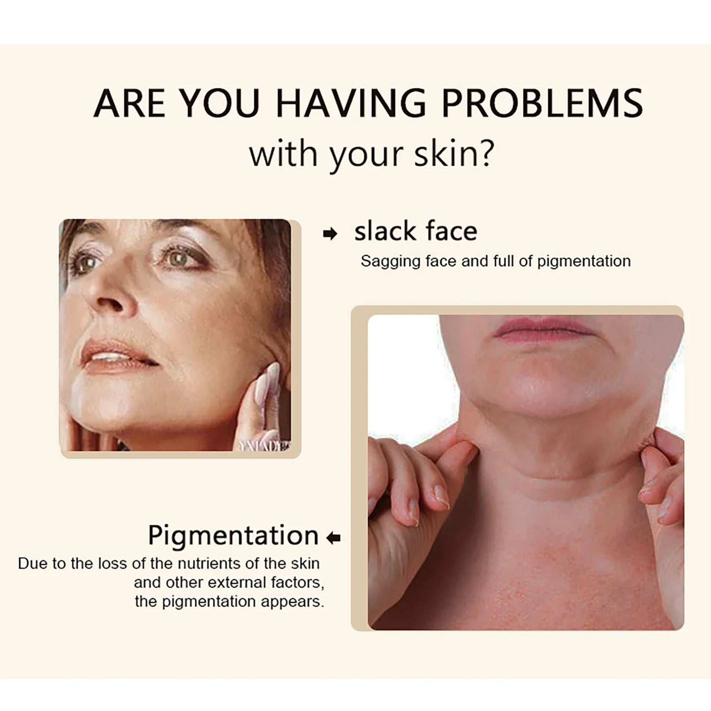 Kyliefit Collagen Whitening Essence For Face And Body