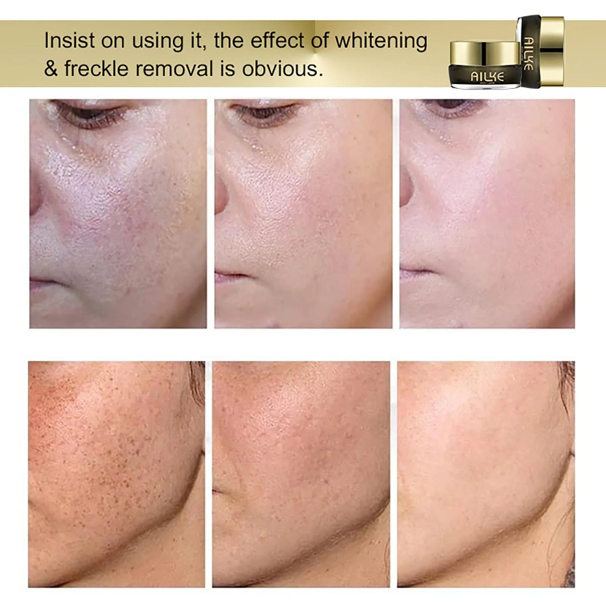 AILKE Whitening Face Cream for Dark Spots and Hyperpigmentation